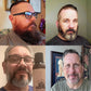 Thinning Hair Kit